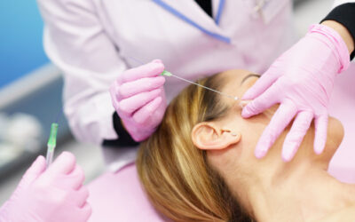 Hilos PDO-Espiculados(Lifting y tensado facial)